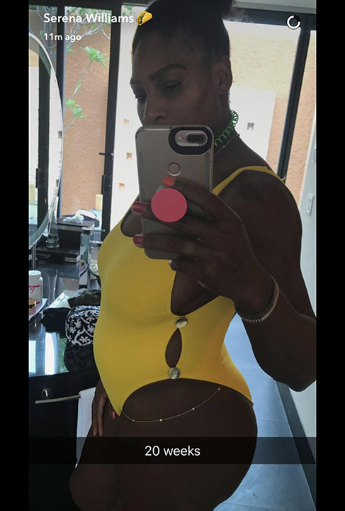 Serena Williams Pregnancy
