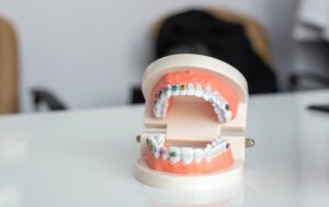 Teeth correction