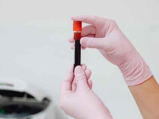 what blood tests show overall health