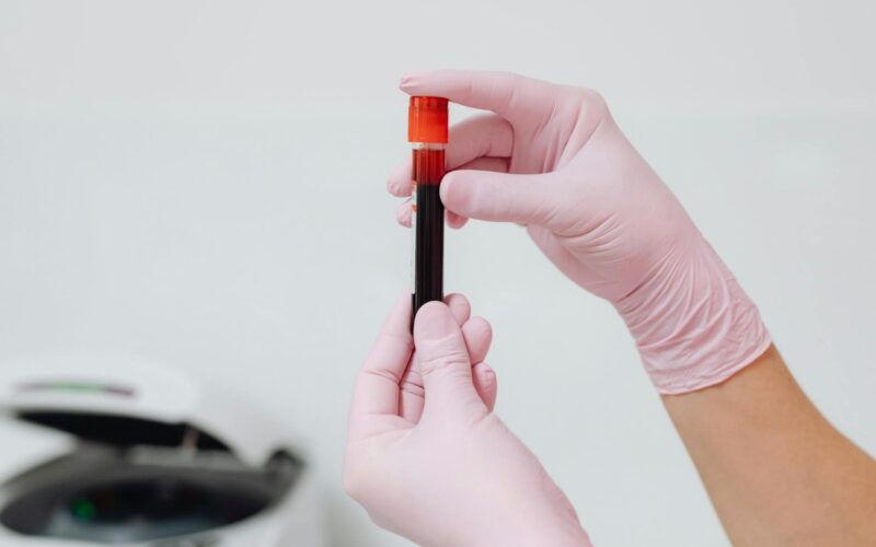 what blood tests show overall health