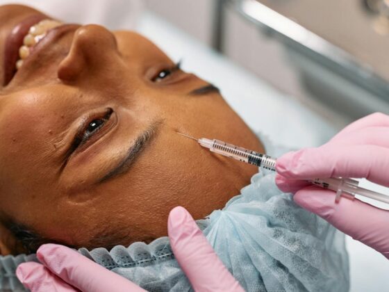what to expect during botox session