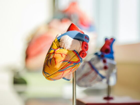Cardiovascular